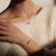 Daniel Wellington 22MM
